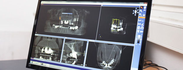3D-Röntgendiagnostik – Digitale Volumentomographie in der Zahnarztpraxis Dr. med. dent. Ralf Michael Dürr und Jeanette Dürr in Vaihingen