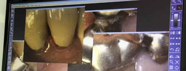 Intraoralkamera – Livebilder für eine transparente Diagnostik in der Zahnarztpraxis Dr. Dürr in Vaihingen